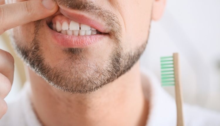 Diş İltihabı Nedenleri
