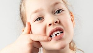 Erken Yaşta Diş Kaybının Nedenleri